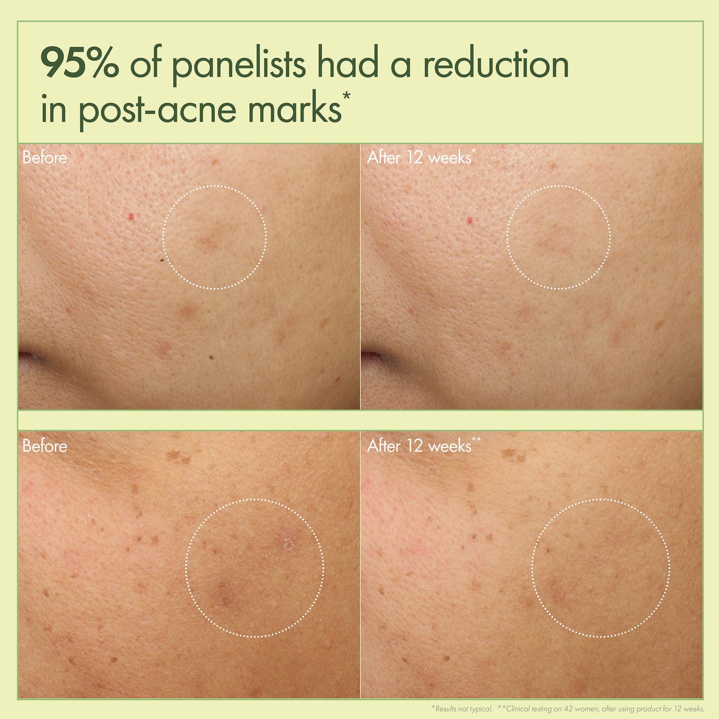 Dr. Andrew Weil for Origins™ MEGA-MUSHROOM Dark Spot Corrector Moisturizer