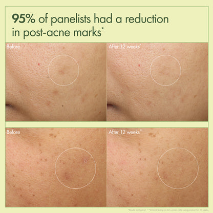 Dr. Andrew Weil for Origins™ MEGA-MUSHROOM Dark Spot Corrector Moisturizer